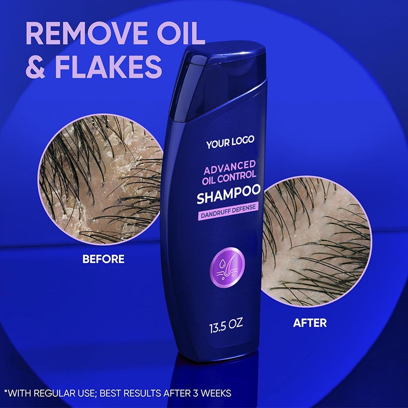 Zinc Pyrithione Gentle Anti-Dandruff Shampoo best