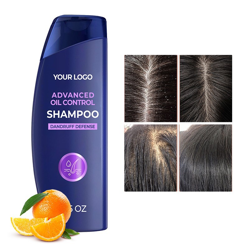 Zinc Pyrithione Gentle Anti-Dandruff Shampoo factory
