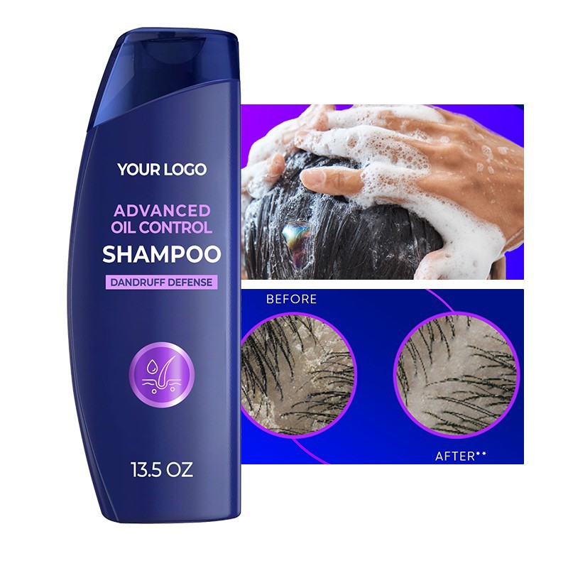 Zinc Pyrithione Gentle Anti-Dandruff Shampoo high quality